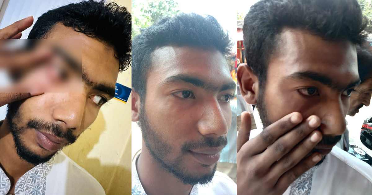 উল্লাপাড়ায় শিবির নেতার ওপর হামলা ব্লক