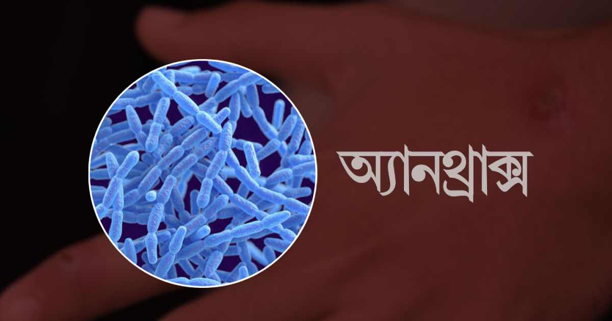 সূচক