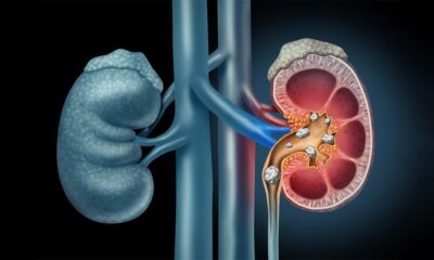 পিই রেশিও